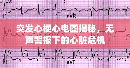 突发心梗心电图揭秘，无声警报下的心脏危机